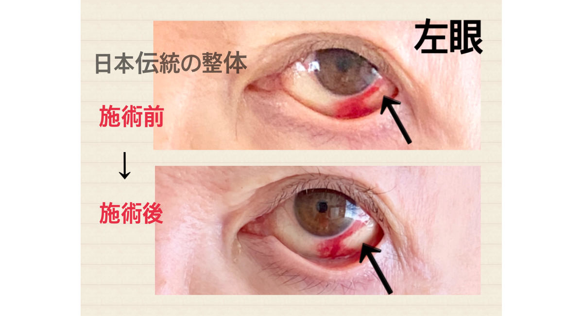 赤ちゃんの原因