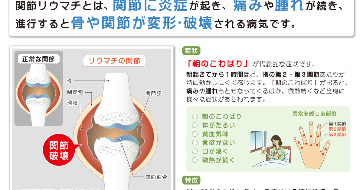 関節リウマチと当院の施術について 横浜で評判の整体院 横浜visseマッサージ治療院のブログ